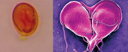 Giardia and coccidia